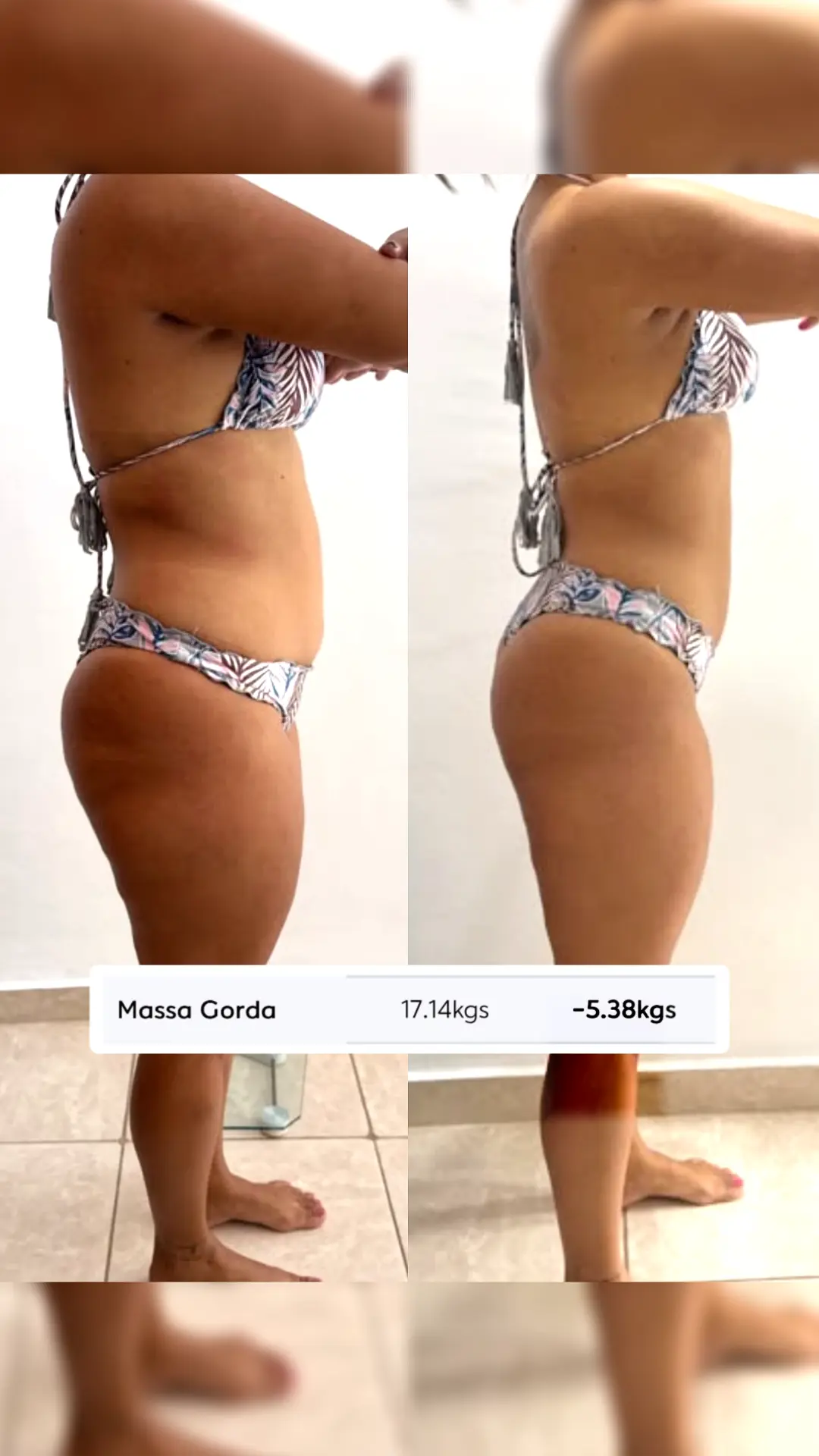 Comparativo de antes e depois de Sheyla, vista lateral