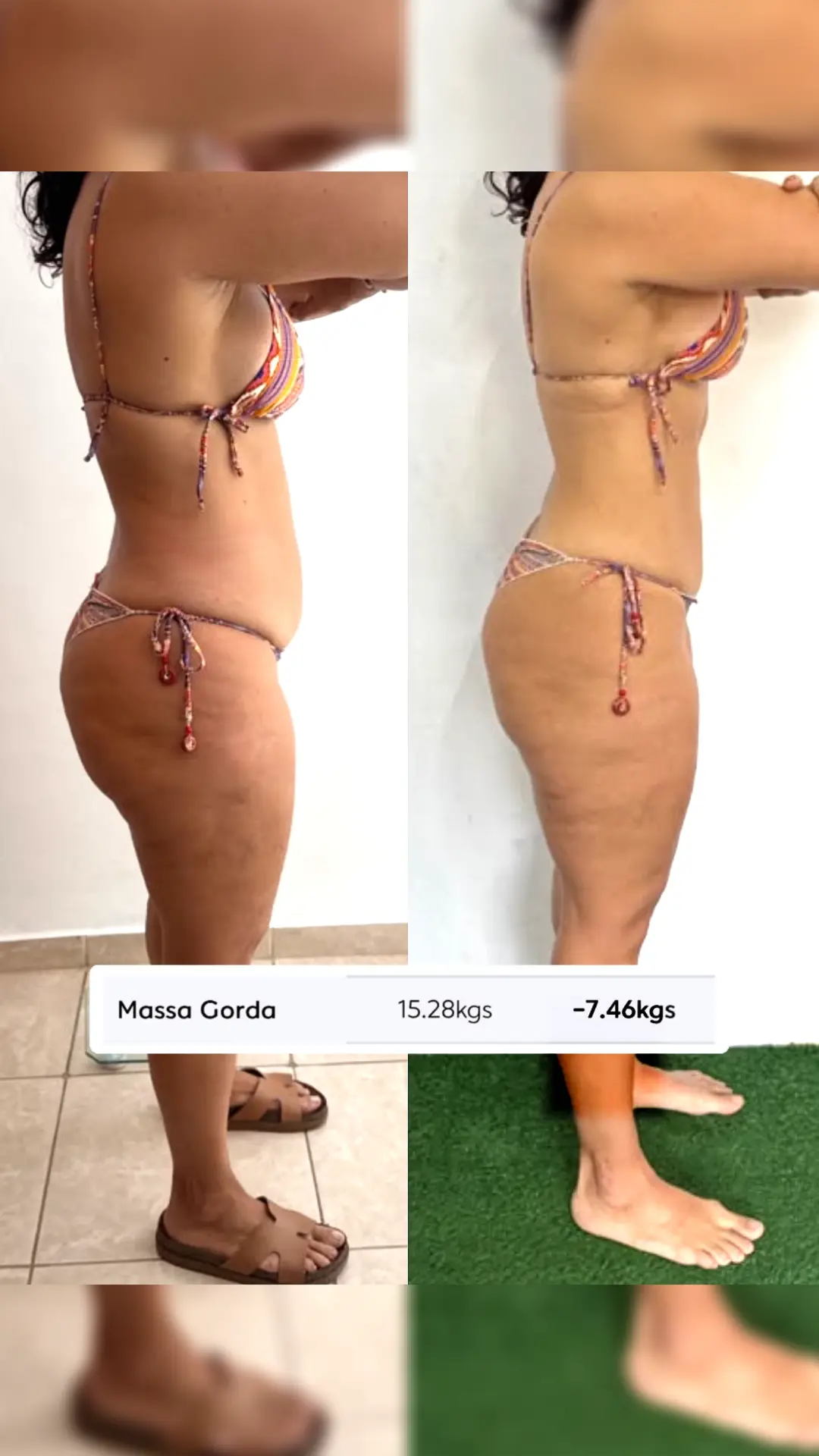 Comparativo de antes e depois de Ju, vista lateral