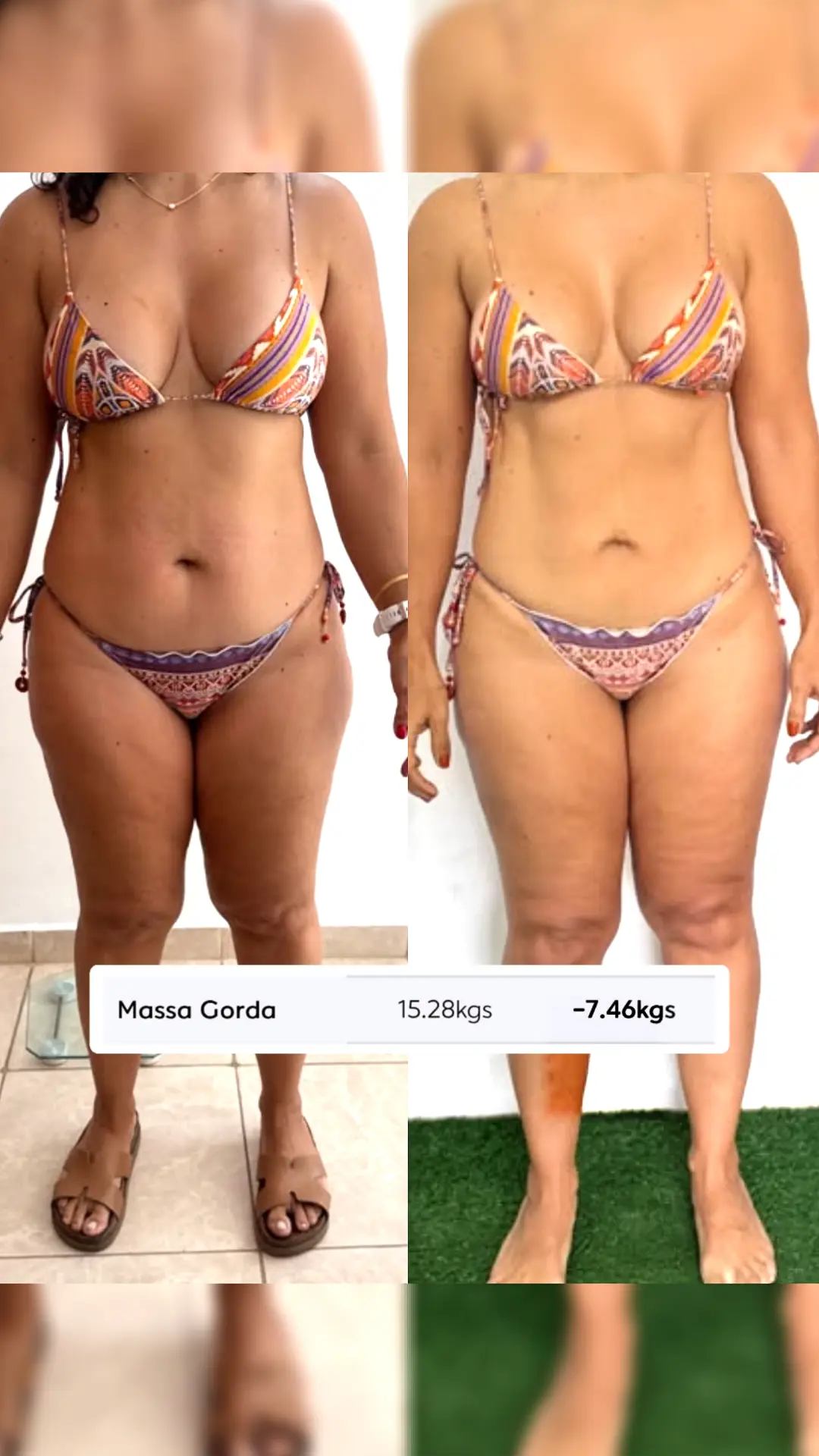 Comparativo de antes e depois de Ju, vista frontal